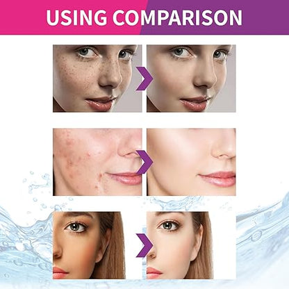 Spot Fading Urea ,Dark Spot Reducing,𝐖𝐡𝐢𝐭𝐞𝐧𝐢𝐧𝐠 and 𝐅𝐫𝐞𝐜𝐤𝐥𝐞 Removal Cream