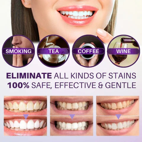 HiSmile V34 Colour Corrector Serum (Teeth Whitening)