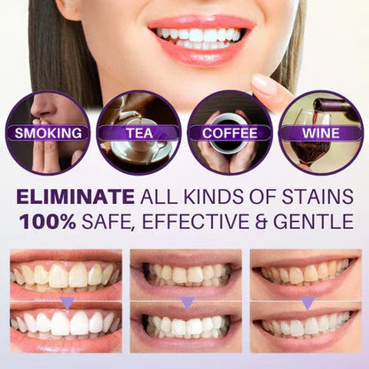 HiSmile V34 Colour Corrector Serum (Teeth Whitening)