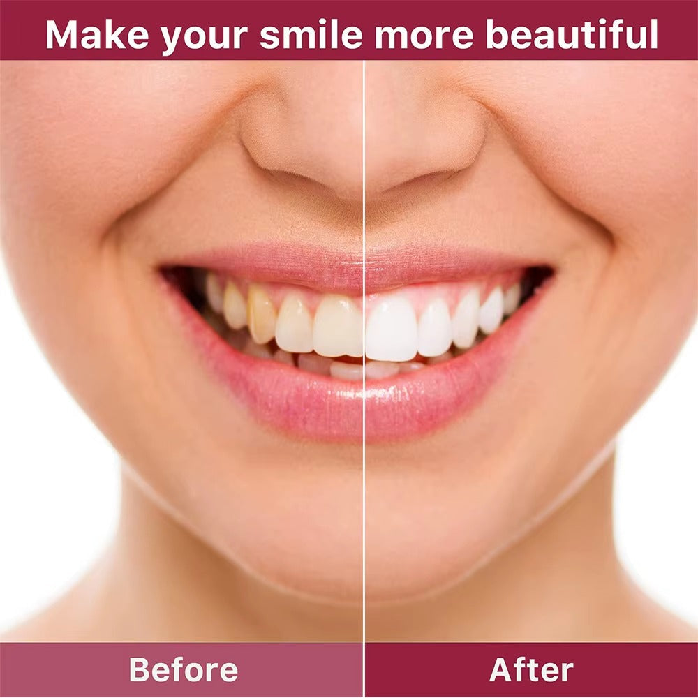 Whitening Toothpaste Sp4 Ultra Whitening Teeth Plaque Remover