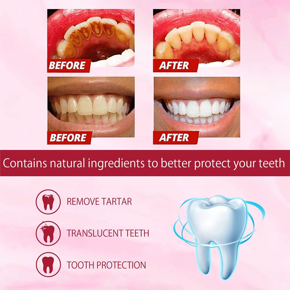 Whitening Toothpaste Sp4 Ultra Whitening Teeth Plaque Remover