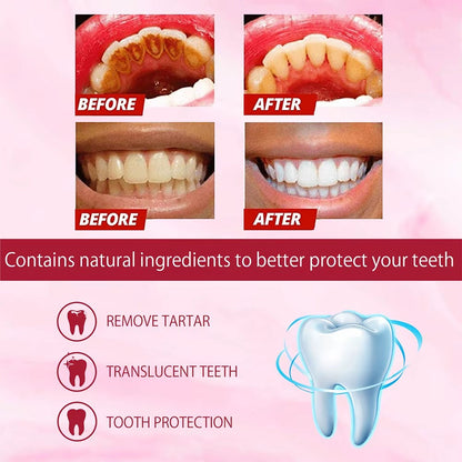 Whitening Toothpaste Sp4 Ultra Whitening Teeth Plaque Remover
