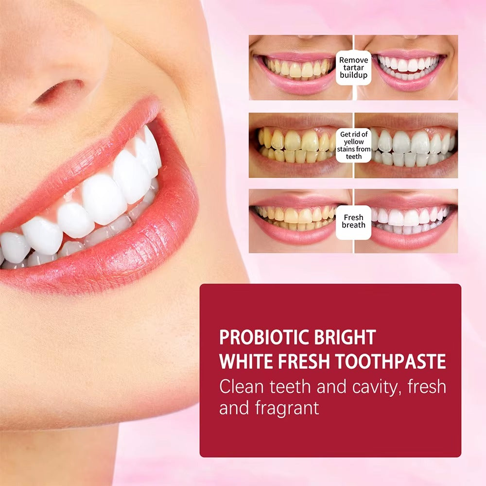 Whitening Toothpaste Sp4 Ultra Whitening Teeth Plaque Remover